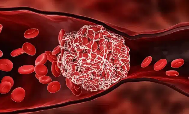 Mengenal Lebih Dekat: Tahapan Pembekuan Darah dalam Tubuh Manusia